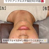 画像546