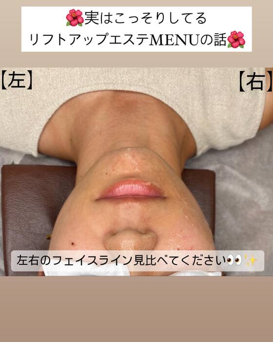 画像546