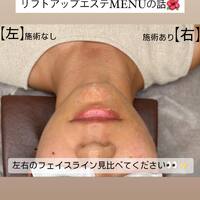 画像547