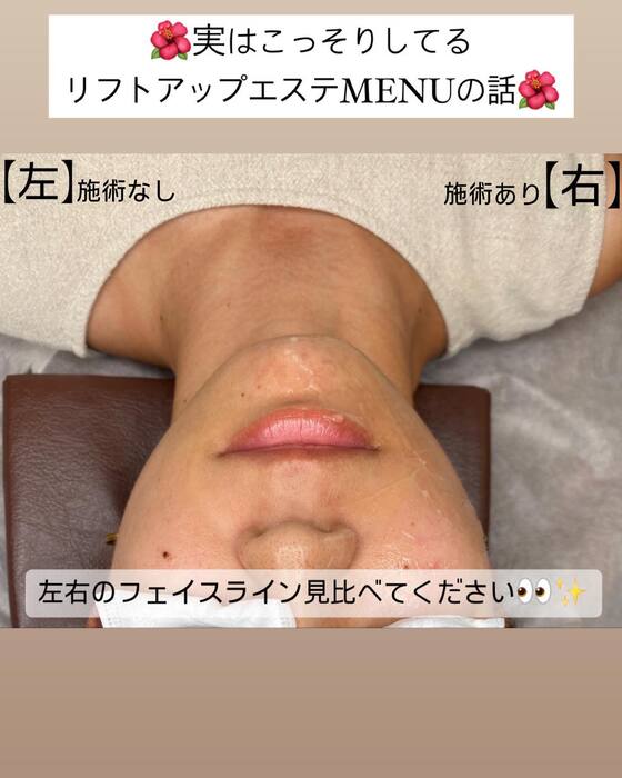 画像547