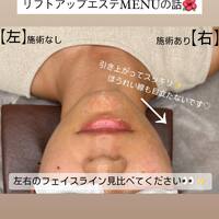 画像548
