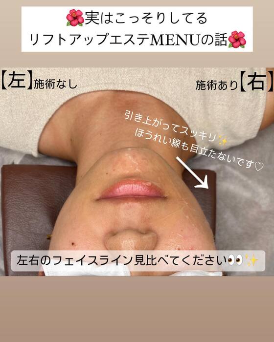 画像548
