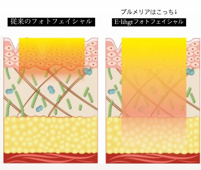 画像664