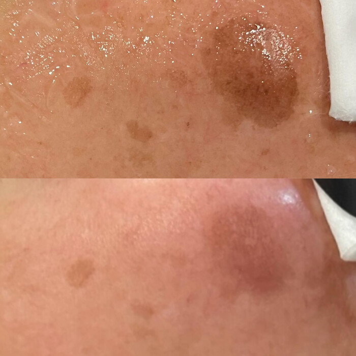 画像737