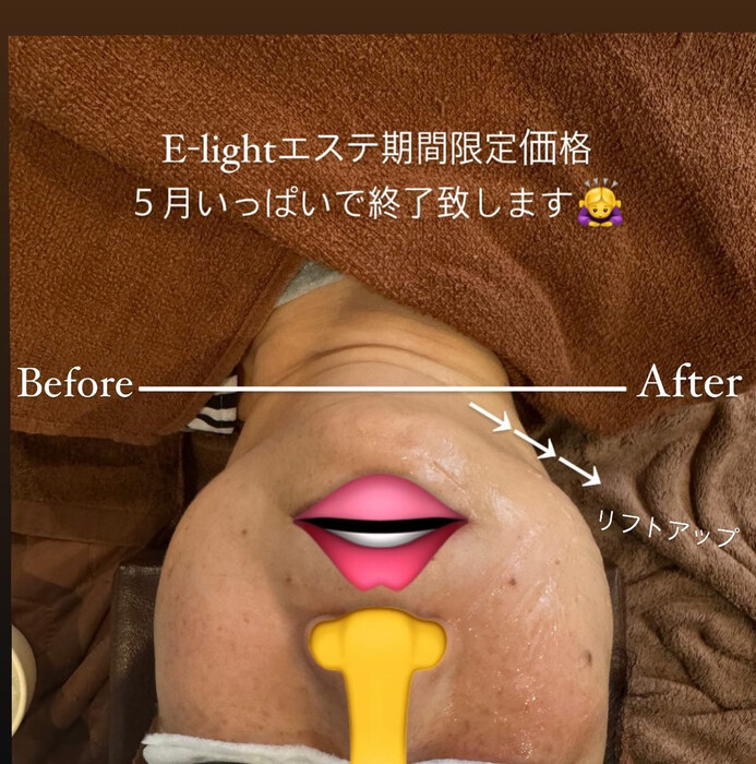 画像750